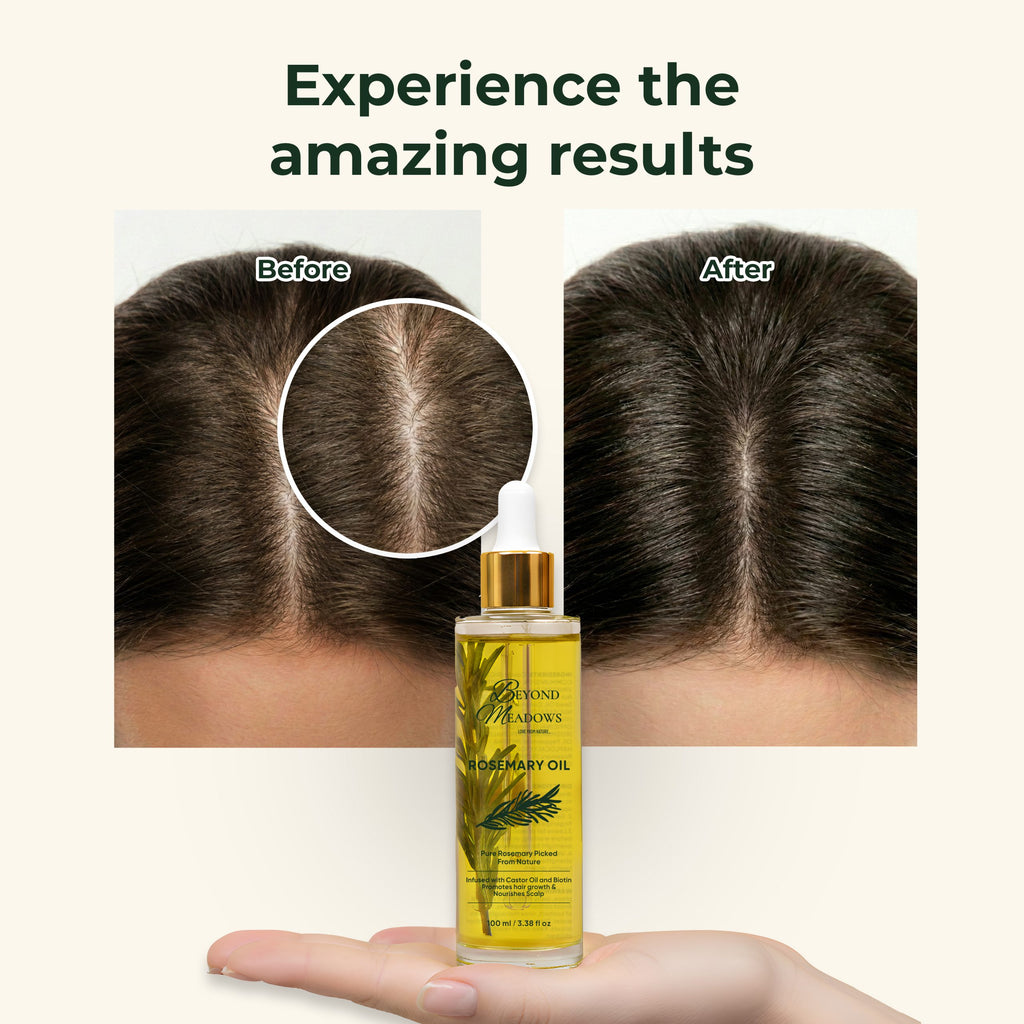 Rosemary Oil